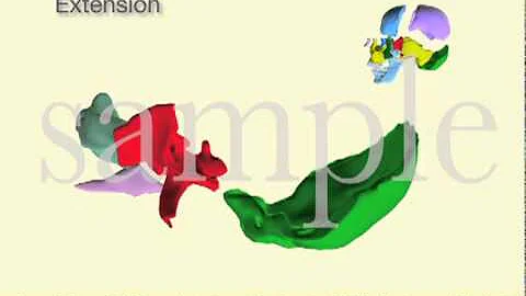 Sphenoid, Occiput, Vomer and Ethmoid CSR Motion by...