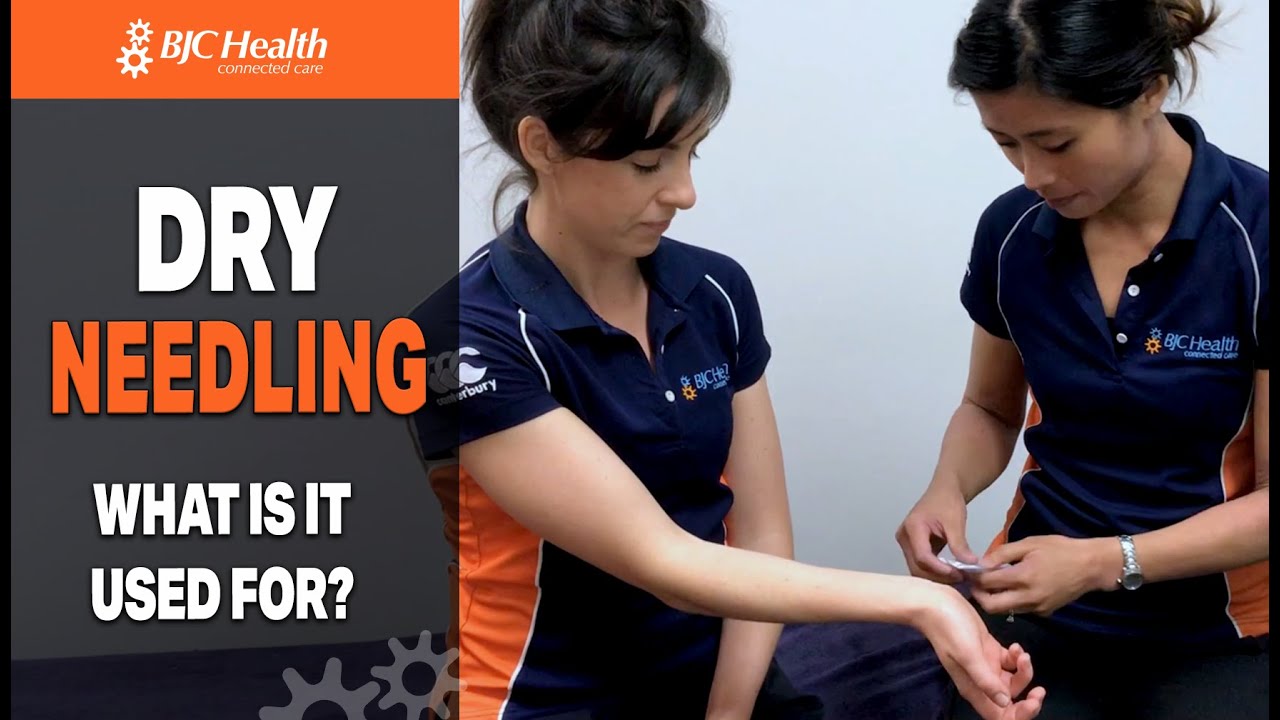 Dry Needling How Does It Differ From Acupuncture What Is It Used For Dry needling how does it differ from acupuncture what is it used for