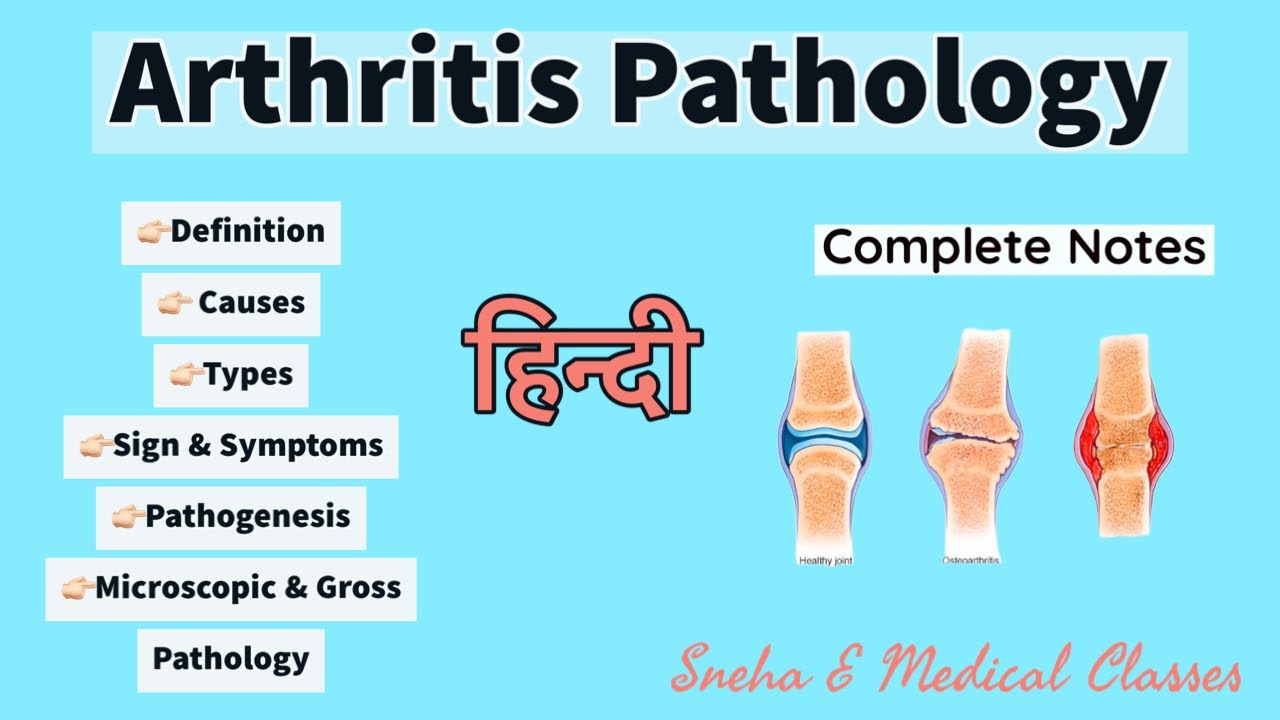 Pathology of Arthritis !! Hindi !! Gross and Microscopic Pathology !! YouTube