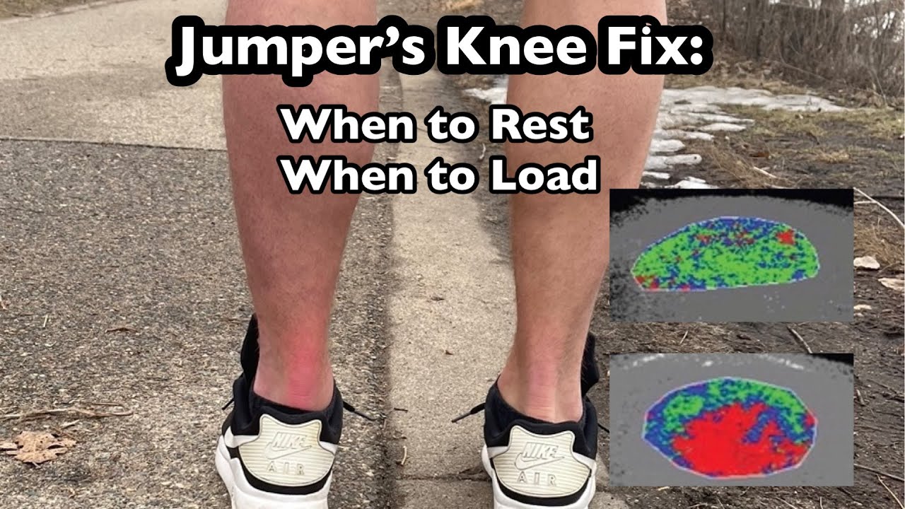 Jumper’s Knee Resting (Fix Patellar Tendon Pain) YouTube