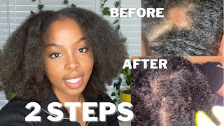 How I Grew My Bald Spot Back FAST! | Big Chop Update screenshot 4