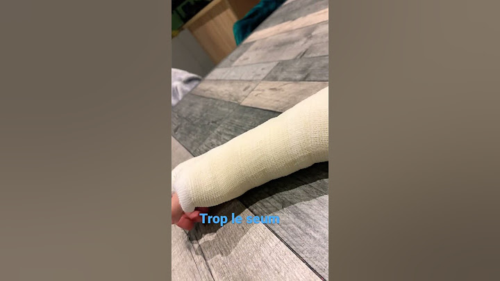 Je me suis fracturé le coude j’ai trop le seum