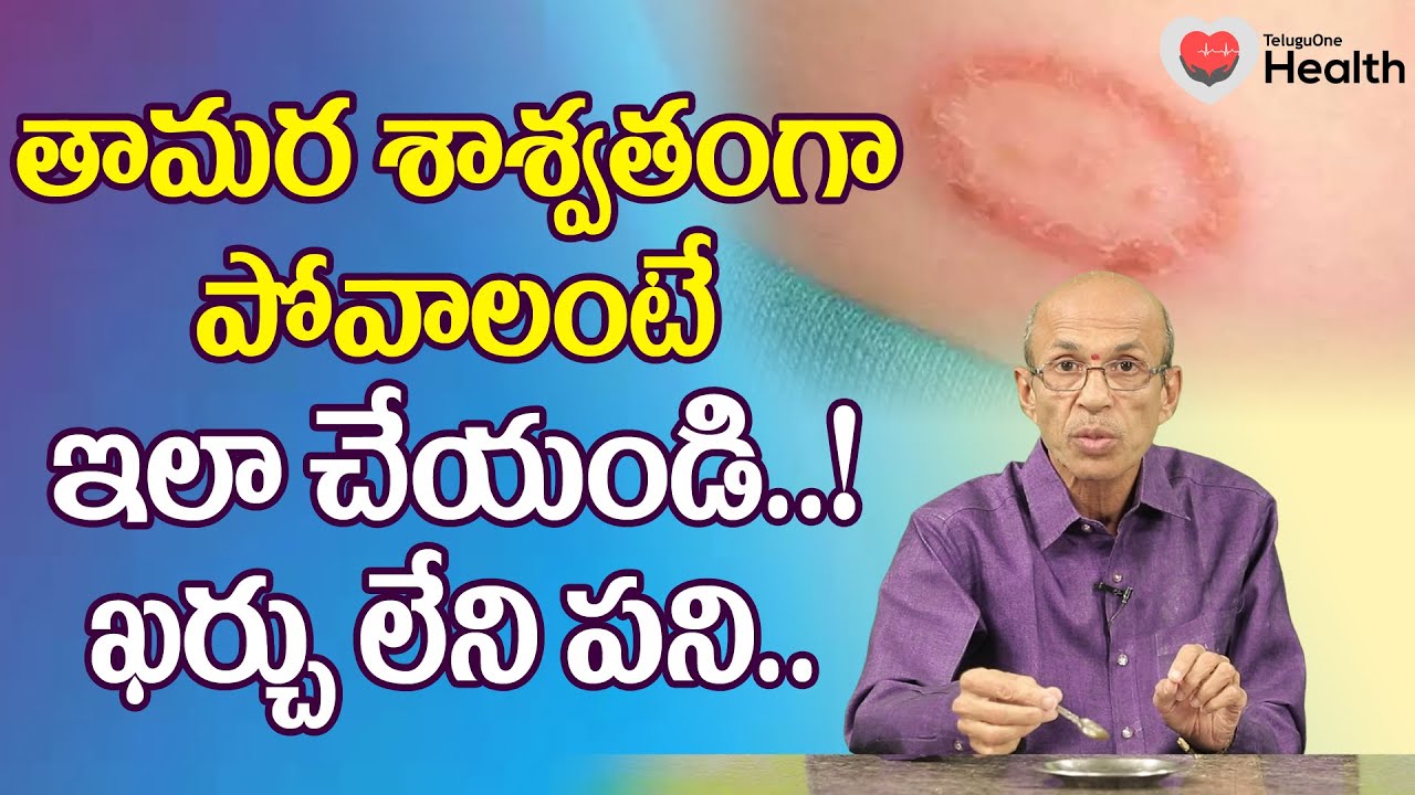 Tamara | తామర శాశ్వతంగా పోవాలంటే ఇలా చేయండి..! Dr. Ch Madhusudana Sarma | TeluguOne Health