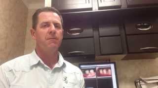 Silver vs. White fillings