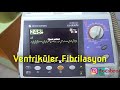 Ventriküler Fibrilasyon - Ventricular Fibrillation