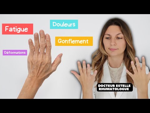 Vidéo: Quand la polyarthrite rhumatoïde est une douleur au cou : des traitements éprouvés