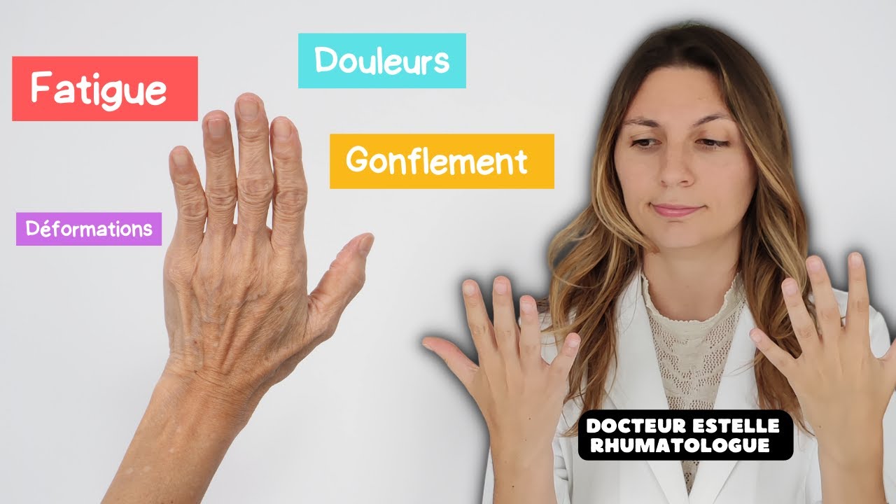 Symptômes de la polyarthrite rhumatoïde - YouTube