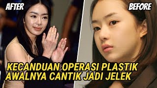 Keseringan Operasi Plastik, 5 Artis Korea Awalnya Cantik Jadi Jelek