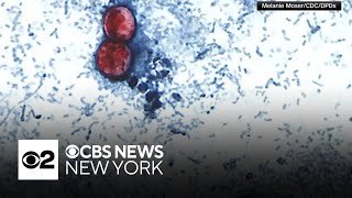 Two deaths confirmed in connection to Cyclosporiasis outbreak in U.S.