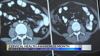 Parkview Health explains how to easily prevent cervical cancer First at 5