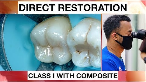 Step by Step Layering Composite I Simple Way | General Dentist Griya RR