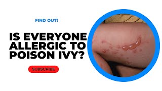 Is Everyone Allergic to Poison Ivy? - Myth Busted!