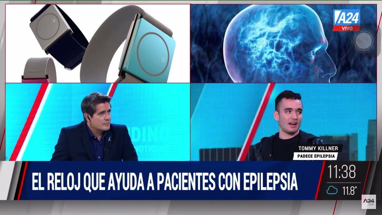 Reloj con inteligencia artificial para monitorear epilepsia