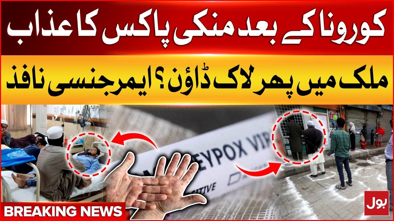 Monkey Pox Virus Spreading In Pakistan | Lockdown In Country ...