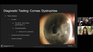 Genetic Testing in Eye Care