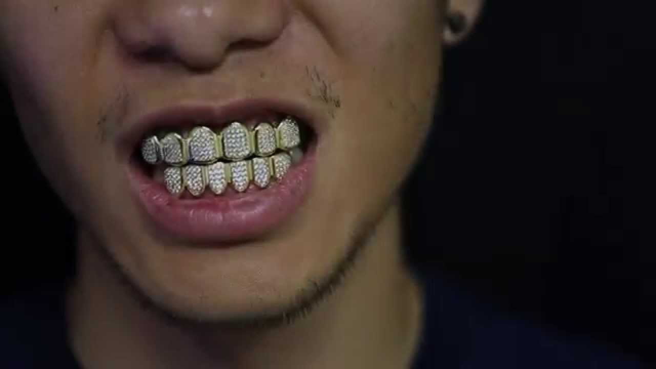 Custom Gold Grillz 18k Gold Diamond Teeth Grillz YouTube