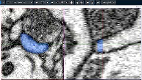 Interpolating Volume Annotations in webKnossos
