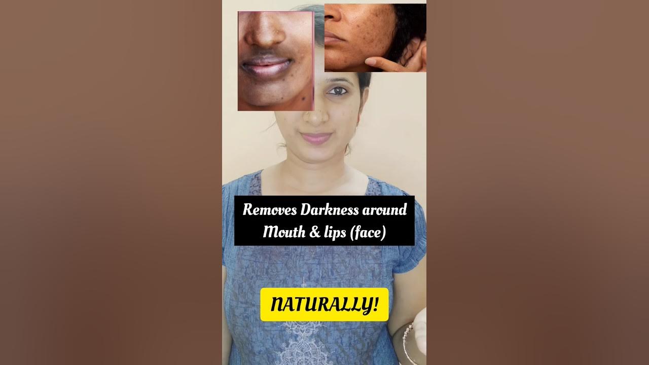 removes-darkness-and-dark-spots-around-lips-face-skinglow-skincare