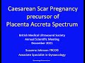 Caesarean Scar Pregnancy: precursor of Placenta Accreta Spectrum