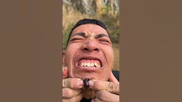 How I Cured a Bug Bite with Yogurt in the Wild | Survival Hacks