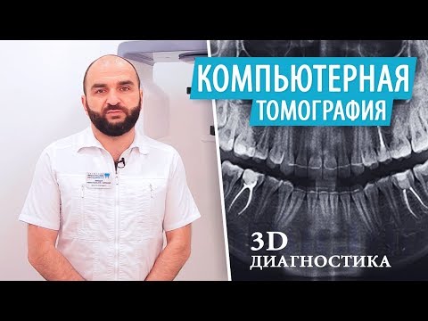 Компьютерная томография зубов (КТ). 3D Диагностика. Рентген зубов