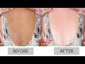 Skin Polishing Full Body Whitening Procedure At Home- Permanent - Spotless Even Toned, Brighter Body