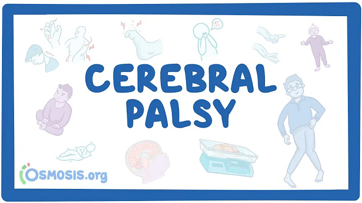 Cerebral palsy (CP) - causes, symptoms, diagnosis, treatment, pathology - DayDayNews
