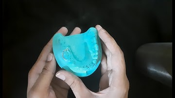 C Clasp Fabrication | Three fourth clasp | Orthodontics | Dental Occlusion