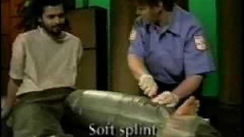 types of splints