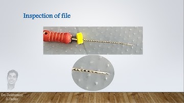 Critical points in Working Length Estimation