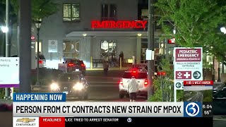 VIDEO: Case of MPOX reported in Connecticut