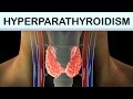 Hyperparathyroidism medical animation