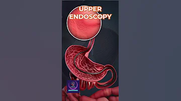 Upper Endoscopy EGD How To Prepare For An Upper Endoscopy Test 