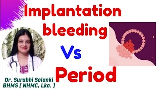 Implantation bleeding vs period | Implantation symptoms | Hindi