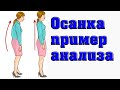 Осанка.Пример визуальной диагностики.