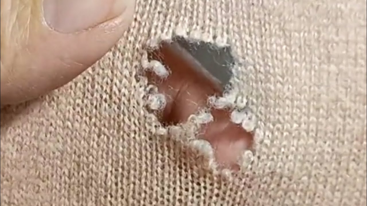 How to perfectly repair a hole in a knitted sweater at home without ...
