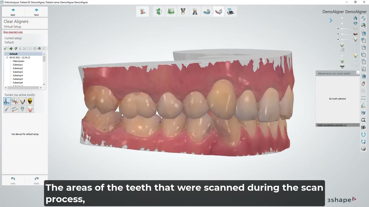 Segmentation in the background in Clear Aligner Studio