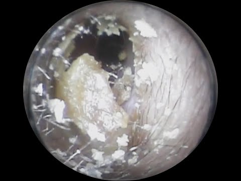 Vol.227【耳掃除】LINEの介情報でご来店☆普段は耳掃除しません〜eariss