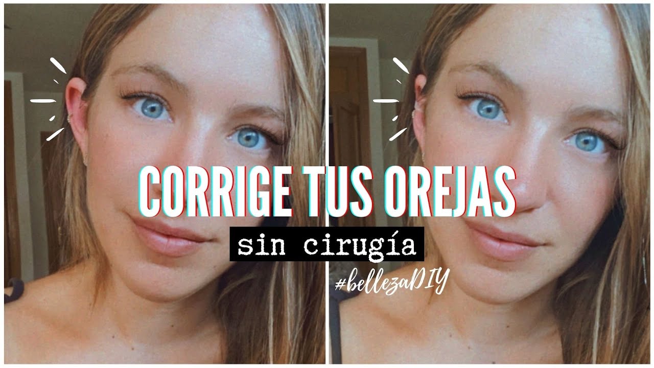 Corrige tus orejas sin cirugía | Monica Beneyto