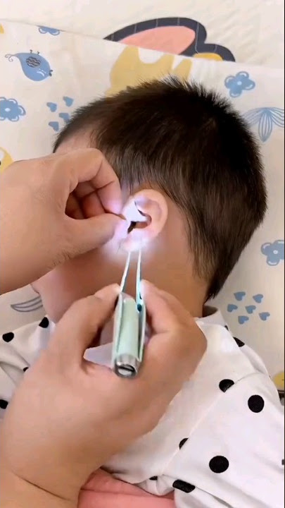 Alat praktis buat korek telinga anak