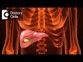How can one treat Adenomyomatosis of Gall bladder? - Dr. Ravindra B S