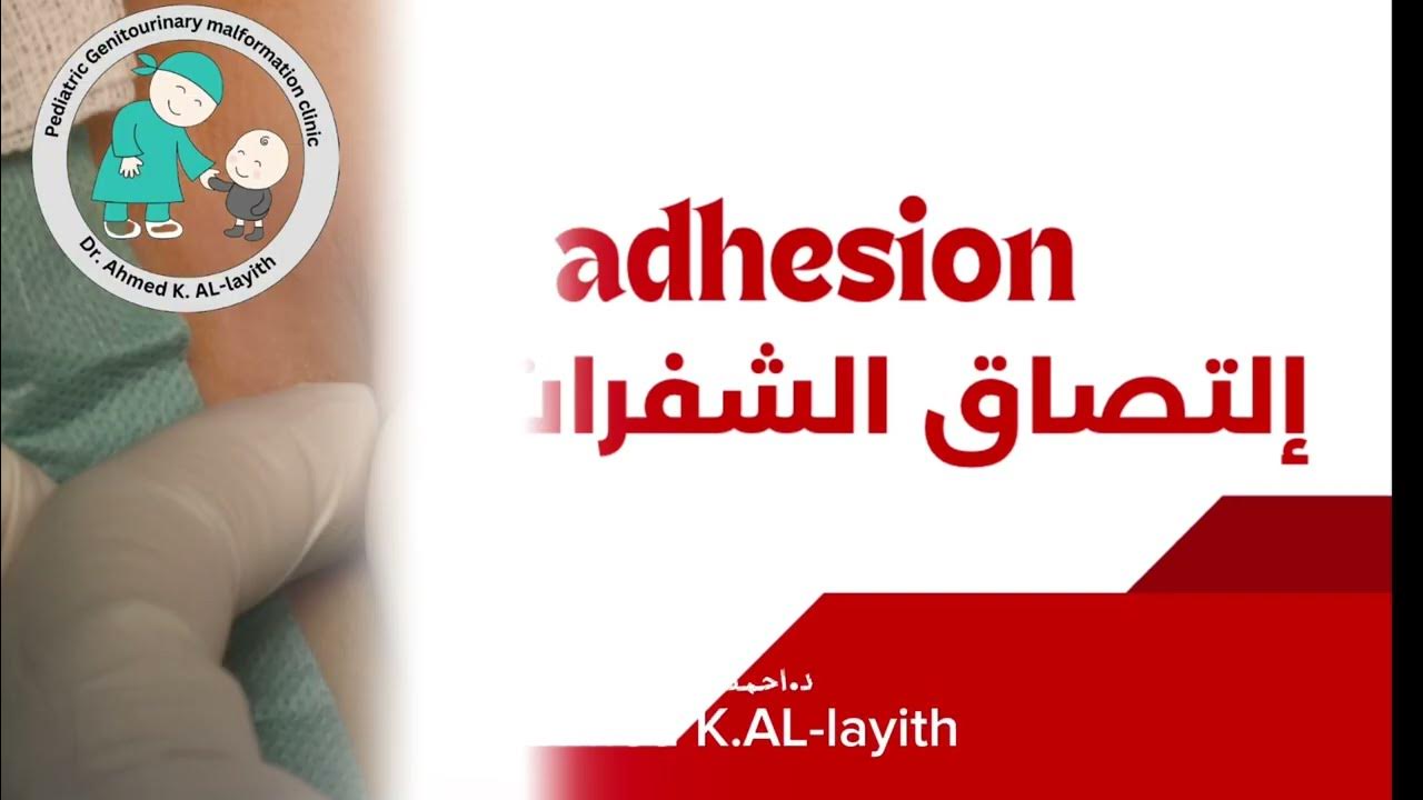  labial adhesion youtube