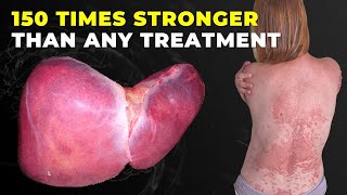 1 Teaspoon Cleans Out Fat in Your Liver 200 Times Stronger Than Garlic and lemon