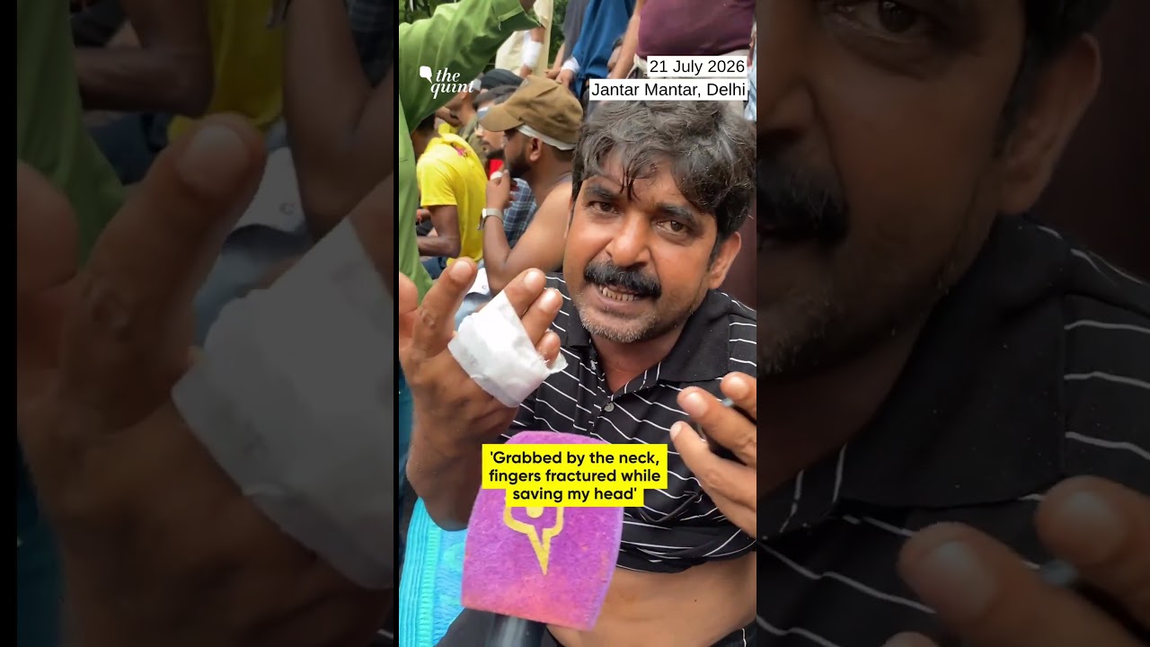 'Grabbed by the neck, fingers fractured while saving my head' CJP Protester Shows Police Brutality