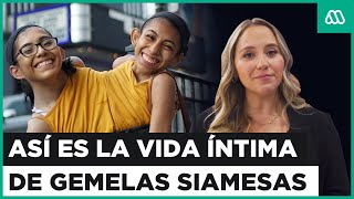 Así es la vida privada de gemelas siamesas: Cómo se coordinan para tener novio