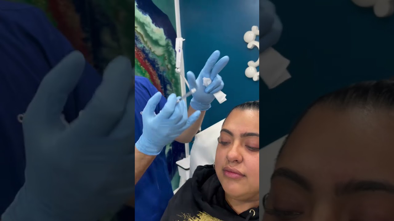 First Botox Treatment Experience | Dr. Dahabra at Beverly Hills Wellness Center & Med Spa 