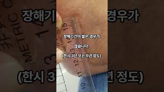 종골분쇄골절 장해 평가 맥브라이드 방식 유리하게 받는 방법(산재 사고) #shorts