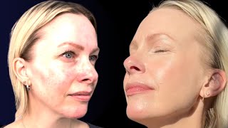 How to get FLAWLESS skin ‼ screenshot 2