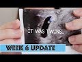 IT WAS TWINS | 6 WEEK PREGNANCY UPDATE | The Hebert House