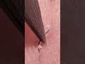 こうやって抜けると気持ちいい #blackheads #毛 #hairpick #satisfying #毛抜き #skincare #抜け毛 #meme